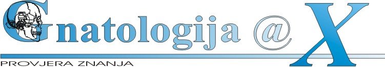 provjera znanja primjer